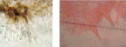 Foto microscopio de queilocistidios en arista de laminas      Foto microscopio de pleurocistidios en caras de laminas   